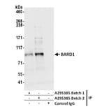 Immunoprecipitation - Anti-BARD1 Antibody (A295385) - Antibodies.com