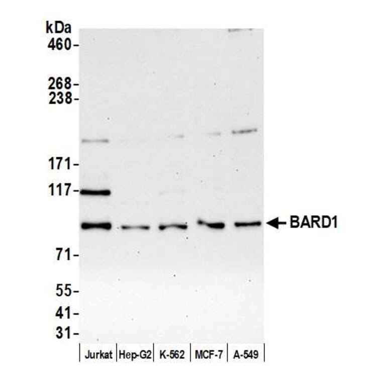 Western Blot - Anti-BARD1 Antibody (A295385) - Antibodies.com