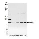 Western Blot - Anti-BARD1 Antibody (A295385) - Antibodies.com