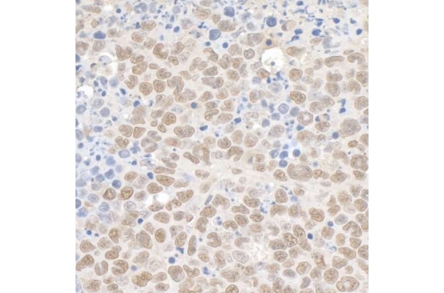 Immunohistochemistry - Anti-KAP1 Antibody (A295397) - Antibodies.com