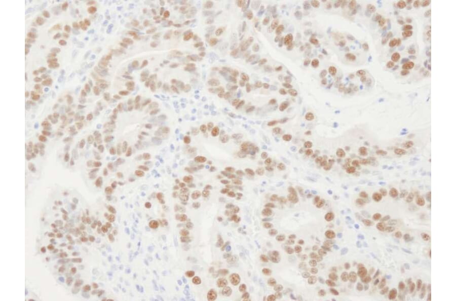 Immunohistochemistry - Anti-PCNA Antibody (A295398) - Antibodies.com