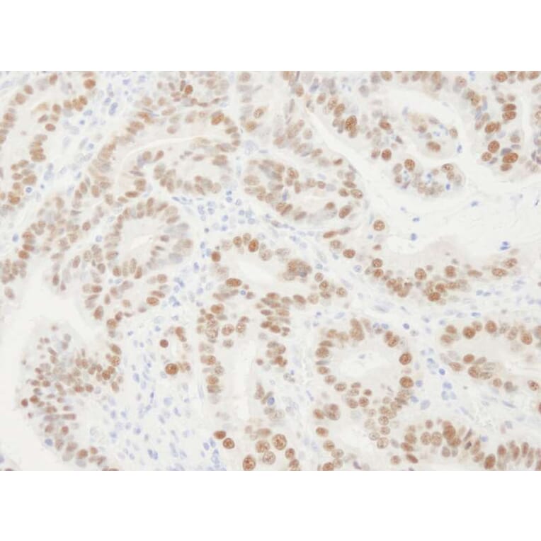Immunohistochemistry - Anti-PCNA Antibody (A295398) - Antibodies.com