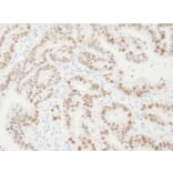 Immunohistochemistry - Anti-PCNA Antibody (A295398) - Antibodies.com