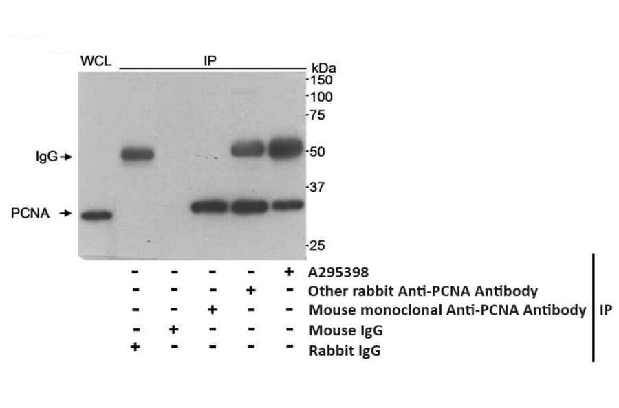 Immunoprecipitation - Anti-PCNA Antibody (A295398) - Antibodies.com