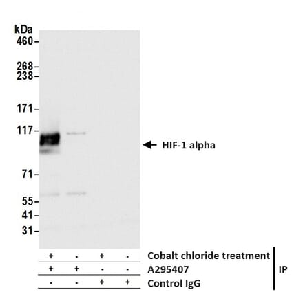 Immunoprecipitation - Anti-HIF-1 alpha Antibody (A295407) - Antibodies.com