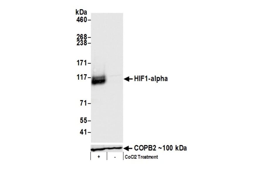 Western Blot - Anti-HIF-1 alpha Antibody (A295407) - Antibodies.com