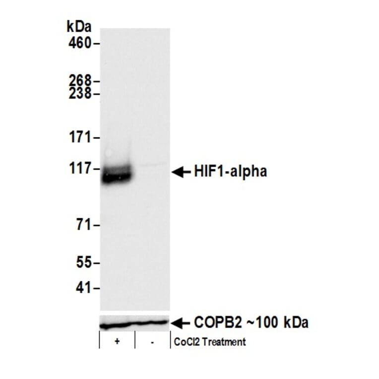 Western Blot - Anti-HIF-1 alpha Antibody (A295407) - Antibodies.com