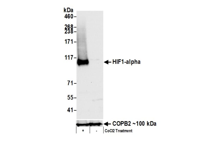 Western Blot - Anti-HIF-1 alpha Antibody (A295407) - Antibodies.com