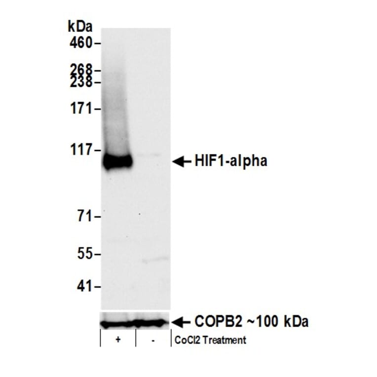 Western Blot - Anti-HIF-1 alpha Antibody (A295407) - Antibodies.com