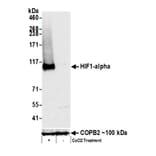 Western Blot - Anti-HIF-1 alpha Antibody (A295407) - Antibodies.com