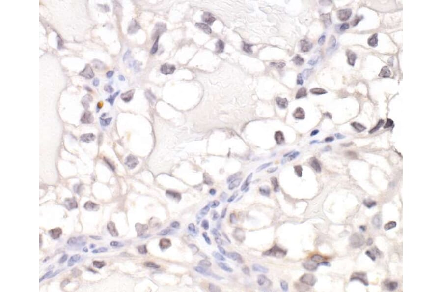 Immunohistochemistry - Anti-HIF-1 alpha Antibody (A295407) - Antibodies.com