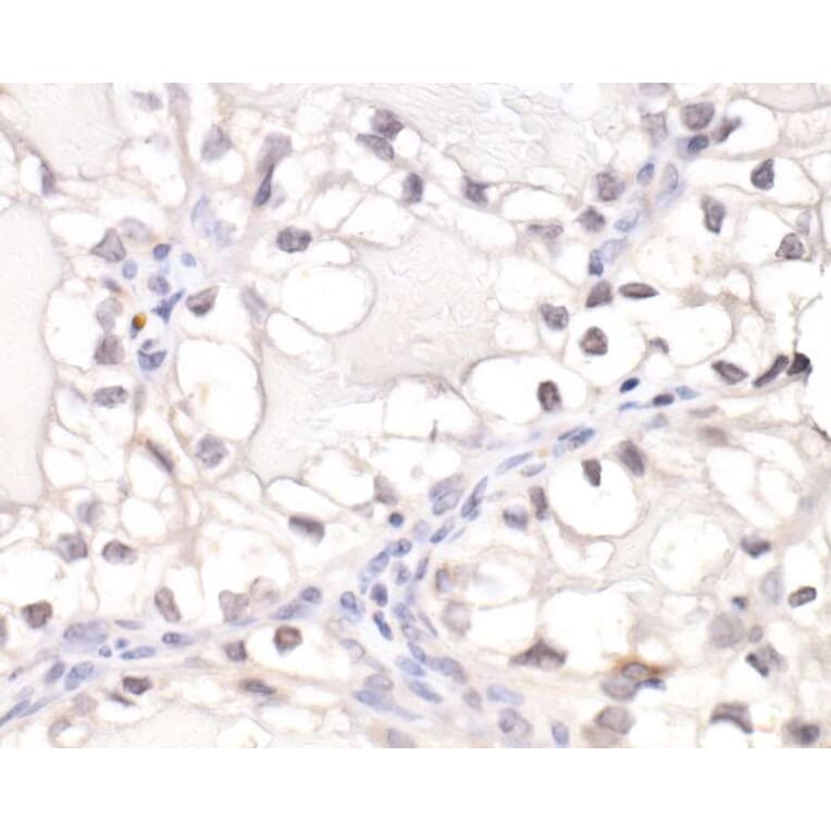 Immunohistochemistry - Anti-HIF-1 alpha Antibody (A295407) - Antibodies.com