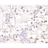 Immunohistochemistry - Anti-HIF-1 alpha Antibody (A295407) - Antibodies.com