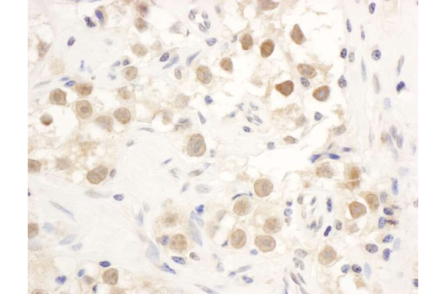Immunohistochemistry - Anti-Chk1 Antibody (A295417) - Antibodies.com