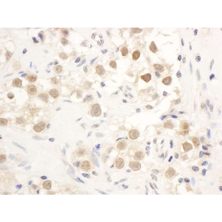 Immunohistochemistry - Anti-Chk1 Antibody (A295417) - Antibodies.com