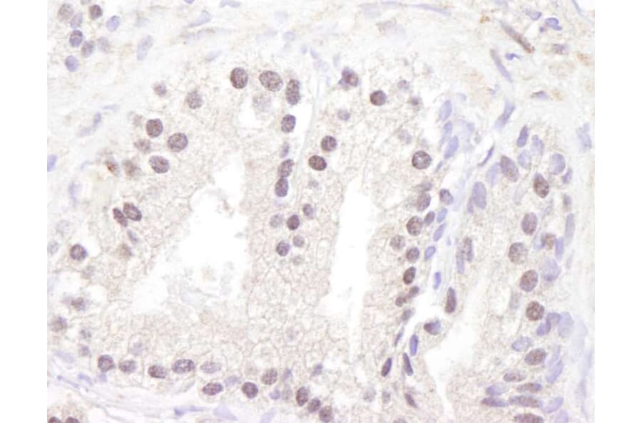 Immunohistochemistry - Anti-ATM Antibody (A295418) - Antibodies.com