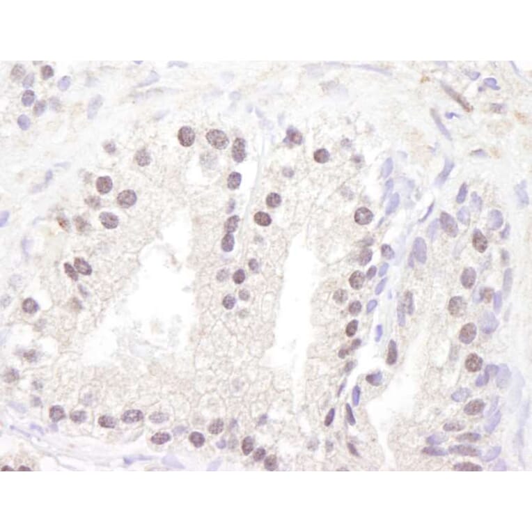 Immunohistochemistry - Anti-ATM Antibody (A295418) - Antibodies.com