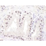 Immunohistochemistry - Anti-ATM Antibody (A295418) - Antibodies.com