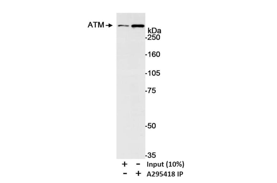 Immunoprecipitation - Anti-ATM Antibody (A295418) - Antibodies.com