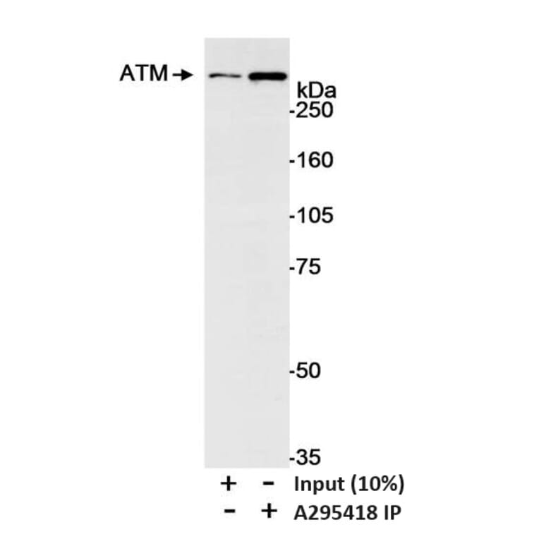 Immunoprecipitation - Anti-ATM Antibody (A295418) - Antibodies.com