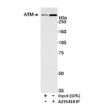 Immunoprecipitation - Anti-ATM Antibody (A295418) - Antibodies.com