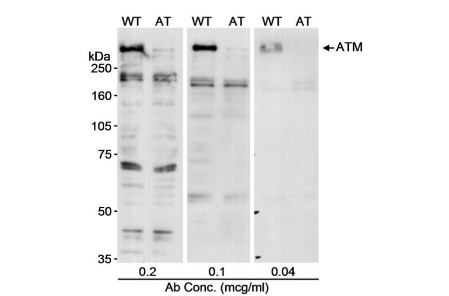 Western Blot - Anti-ATM Antibody (A295418) - Antibodies.com