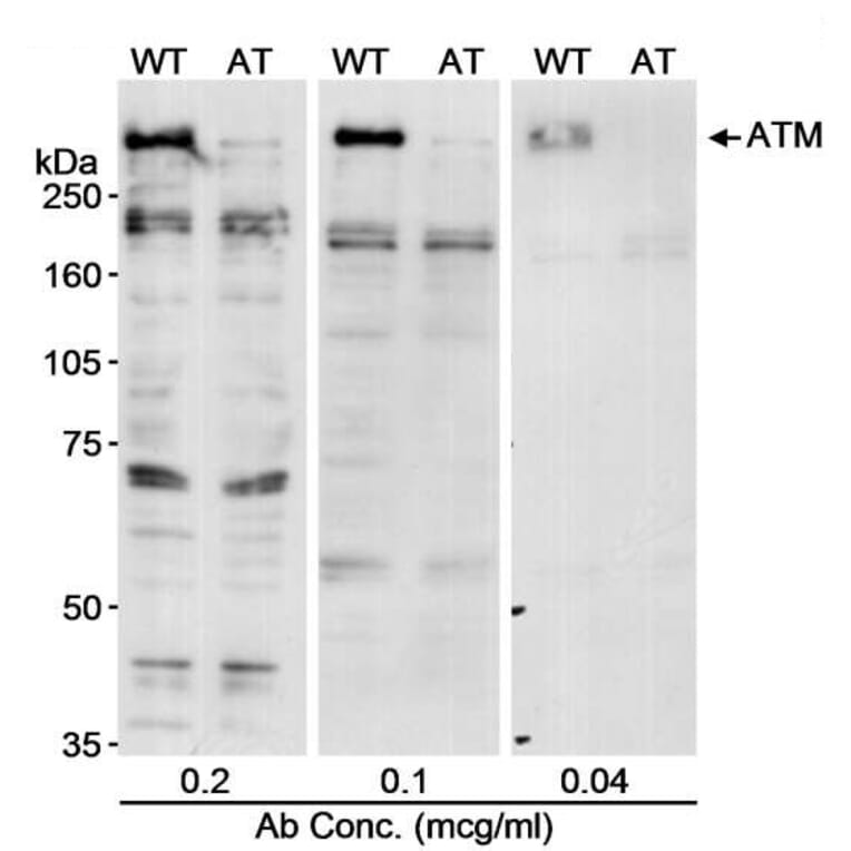 Western Blot - Anti-ATM Antibody (A295418) - Antibodies.com
