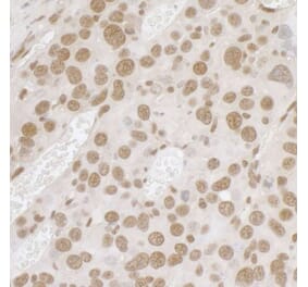 Immunohistochemistry - Anti-TLS / FUS Antibody (A295421) - Antibodies.com