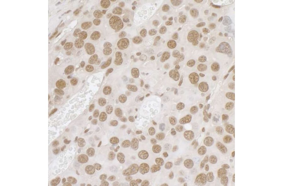 Immunohistochemistry - Anti-TLS / FUS Antibody (A295421) - Antibodies.com