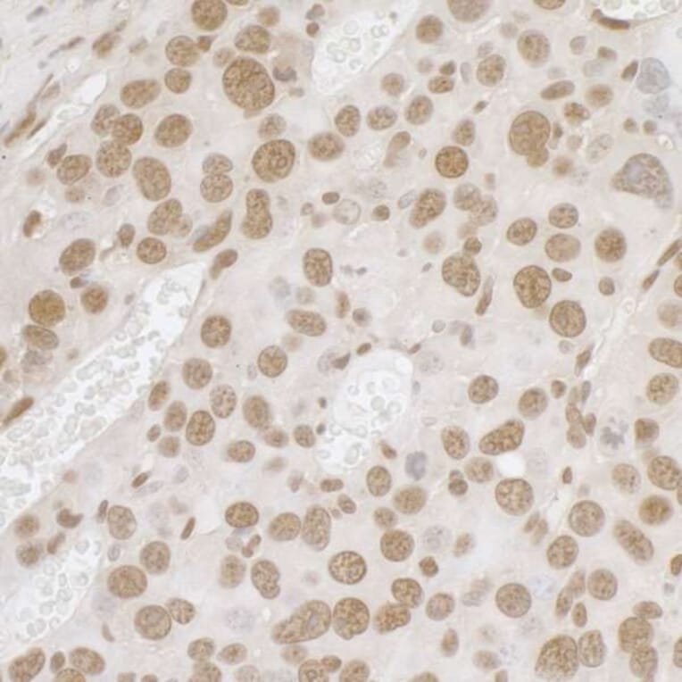 Immunohistochemistry - Anti-TLS / FUS Antibody (A295421) - Antibodies.com