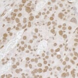 Immunohistochemistry - Anti-TLS / FUS Antibody (A295421) - Antibodies.com