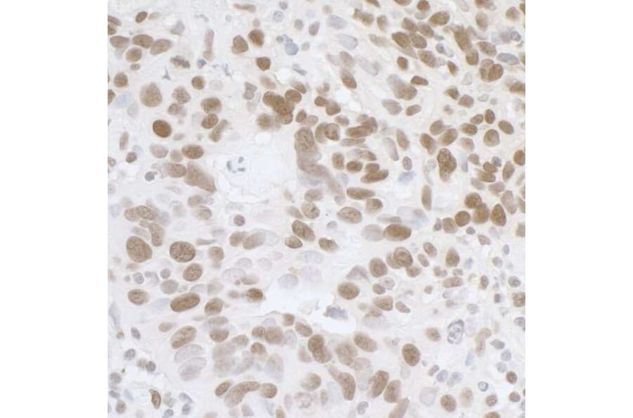 Immunohistochemistry - Anti-TLS / FUS Antibody (A295421) - Antibodies.com