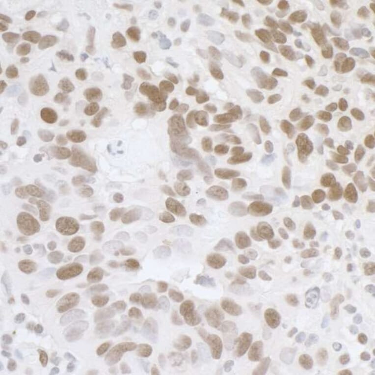 Immunohistochemistry - Anti-TLS / FUS Antibody (A295421) - Antibodies.com