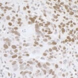 Immunohistochemistry - Anti-TLS / FUS Antibody (A295421) - Antibodies.com