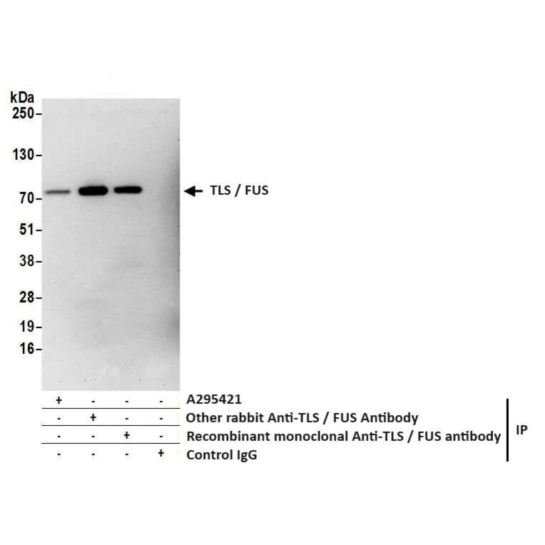 Immunoprecipitation - Anti-TLS / FUS Antibody (A295421) - Antibodies.com