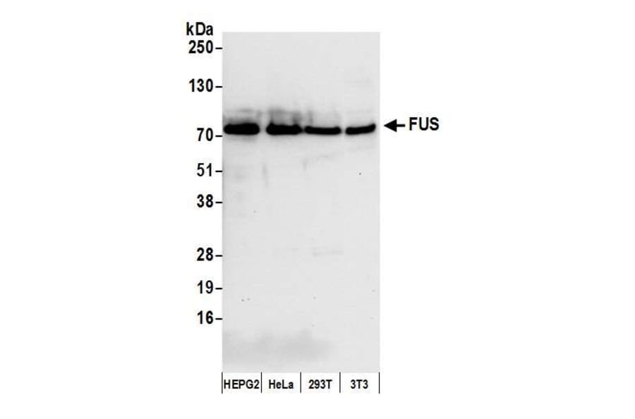 Western Blot - Anti-TLS / FUS Antibody (A295421) - Antibodies.com