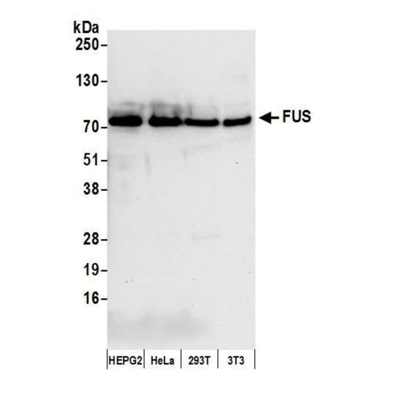 Western Blot - Anti-TLS / FUS Antibody (A295421) - Antibodies.com