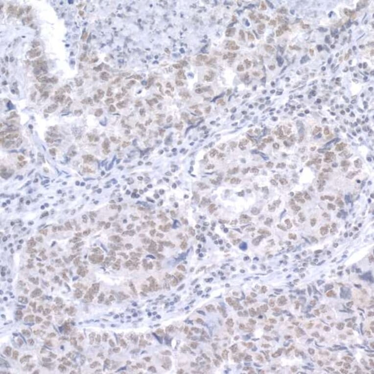 Immunohistochemistry - Anti-RAP1 Antibody (A295425) - Antibodies.com