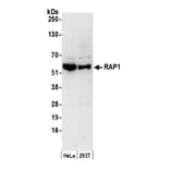 Western Blot - Anti-RAP1 Antibody (A295425) - Antibodies.com