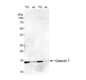 Western Blot - Anti-Galectin 7 Antibody (A295460) - Antibodies.com