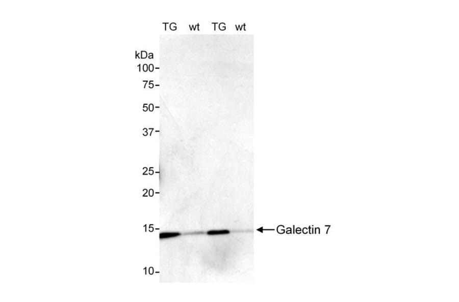 Western Blot - Anti-Galectin 7 Antibody (A295460) - Antibodies.com