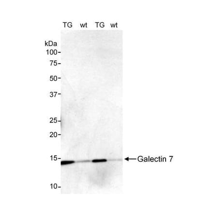 Western Blot - Anti-Galectin 7 Antibody (A295460) - Antibodies.com