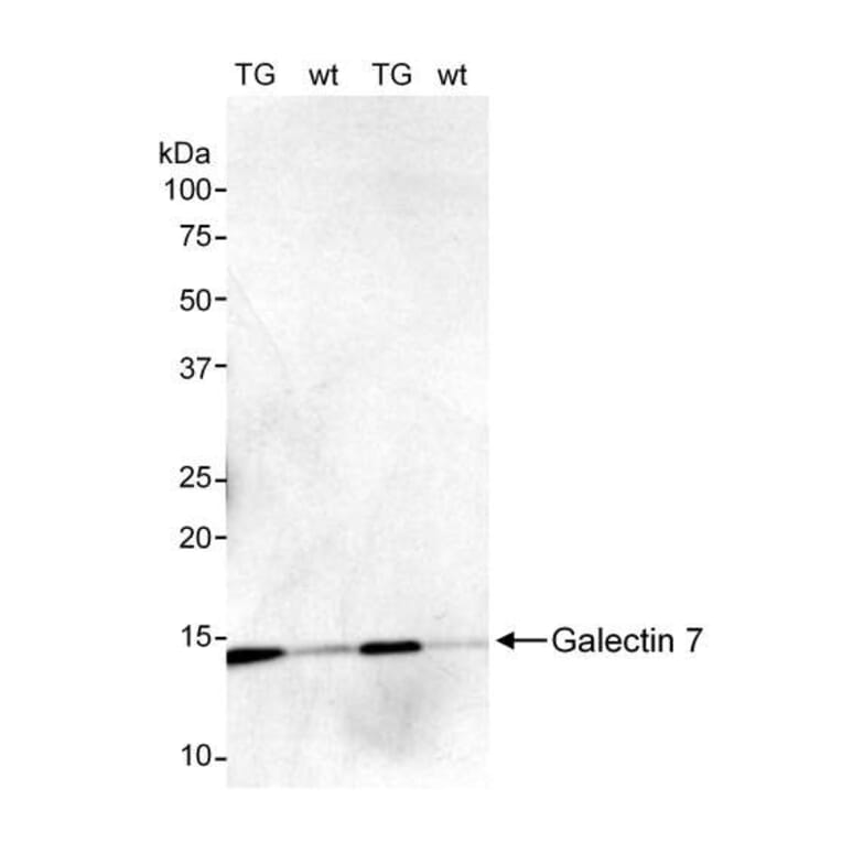 Western Blot - Anti-Galectin 7 Antibody (A295460) - Antibodies.com