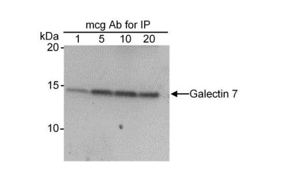 Immunoprecipitation - Anti-Galectin 7 Antibody (A295460) - Antibodies.com