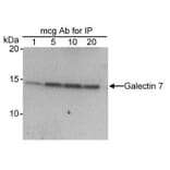 Immunoprecipitation - Anti-Galectin 7 Antibody (A295460) - Antibodies.com