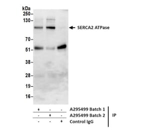 Immunoprecipitation - Anti-SERCA2 ATPase Antibody (A295499) - Antibodies.com