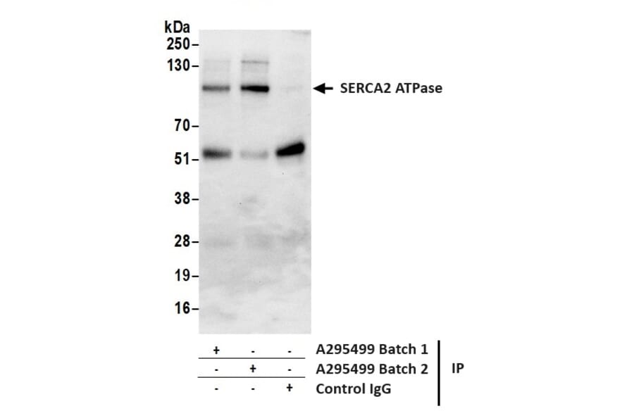 Immunoprecipitation - Anti-SERCA2 ATPase Antibody (A295499) - Antibodies.com