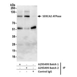 Immunoprecipitation - Anti-SERCA2 ATPase Antibody (A295499) - Antibodies.com