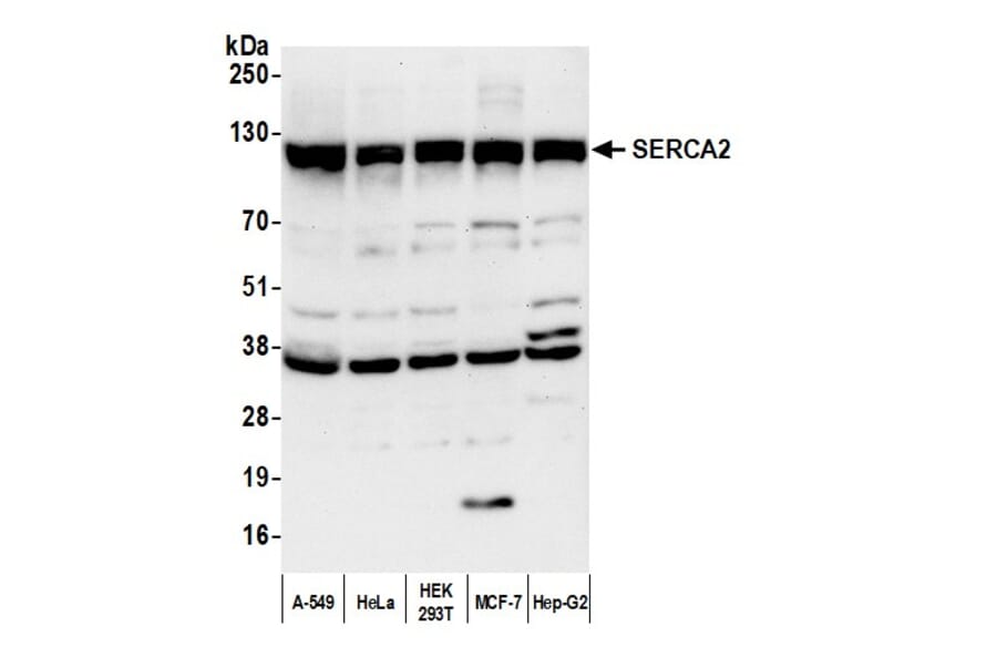 Western Blot - Anti-SERCA2 ATPase Antibody (A295499) - Antibodies.com