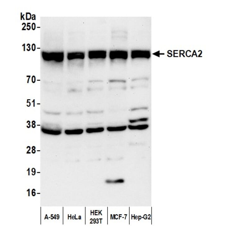 Western Blot - Anti-SERCA2 ATPase Antibody (A295499) - Antibodies.com